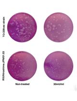 Analysis of the Effect of Sphingomyelinase on Rubella Virus Infectivity in Two Cell Lines