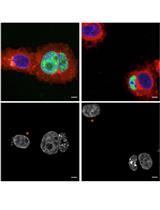 A Quantitative Heterokaryon Assay to Measure the Nucleocytoplasmic Shuttling of Proteins
