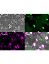 Platelet Migration and Bacterial Trapping Assay under Flow