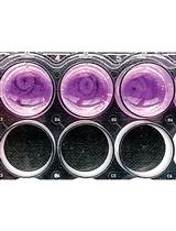 Activation of Fibroblast Contractility via Cell-Cell Interactions and Soluble Signals