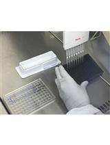 High-throughput Microscopic Analysis of Salmonella Invasion of Host Cells