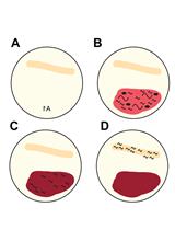 6-hydroxydopamine (6-OHDA) Oxidative Stress Assay for Observing Dopaminergic Neuron Loss in Caenorhabditis elegans