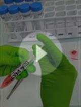 小鼠肺ILC2s的分离和培养