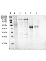 Expression and Ni-NTA-Agarose Purification of Recombinant Hepatitis C Virus E2 Ectodomain Produced in a Baculovirus Expression System
