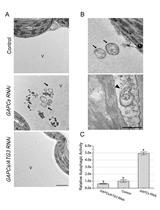 Examining Autophagy in Plant by Transmission Electron Microscopy (TEM)