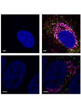 Detection and Differentiation of Multiple Viral RNAs Using Branched DNA FISH Coupled to Confocal Microscopy and Flow Cytometry