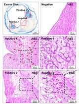Vascular Permeability Assay in Human Coronary and Mouse Brachiocephalic Arteries