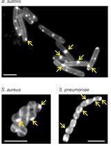 Assessing Membrane Fluidity and Visualizing Fluid Membrane Domains in Bacteria Using Fluorescent Membrane Dyes