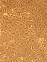 Quantification of Infectious Sendai Virus Using Plaque Assay