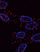 Protocol for <em>in situ</em> Proximity Ligation Assay (PLA) and Microscopy Analysis of  Epidermal Growth Factor Receptor (EGFR) Homodimerization