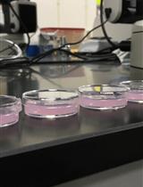 Staining the Germline in Live Caenorhabditis elegans: Overcoming Challenges by Applying a Fluorescent-dye Feeding Strategy
