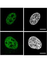 Electroporation of Labeled Antibodies to Visualize Endogenous Proteins and Posttranslational Modifications in Living Metazoan Cell Types