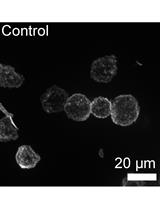 Relative Quantitation of Polymerized Actin in Suspension Cells by Flow Cytometry