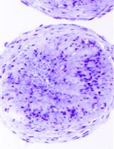 One-step Derivation of Functional Mesenchymal Stem Cells from Human Pluripotent Stem Cells