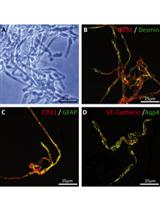 Collagenase-based Single Cell Isolation of Primary Murine Brain Endothelial Cells Using Flow Cytometry 