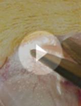 Partial Transection of Adult Rat Optic Nerve as a Model of Secondary Degeneration in the Central Nervous System