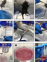 基因沉默对于细菌感染诱导骨髓巨噬细胞中ERK1/2信号通路的影响研究方法