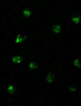 Systematic Quantification of GFP-tagged Protein Foci in <em>Schizosaccharomyces pombe</em> Nuclei