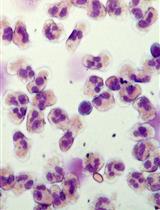人循环中性粒细胞微泡的分离