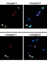 Analysis of DNA Exchange Using Thymidine Analogs (ADExTA) in Trypanosoma cruzi