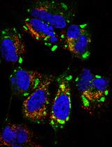 Production, Titration and Imaging of Zika Virus in Mammalian Cells