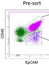 Monitoring Natural Killer Cell Function in Human Ovarian Cancer Cells of Ascitic Fluid