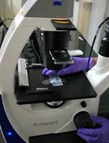 Evaluation of Anticancer activity of Silver Nanoparticles on the A549 Human Lung Carcinoma Cell Lines through Alamar Blue Assay