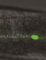 Heterochronic Phenotype Analysis of Hypodermal Seam Cells in Caenorhabditis elegans