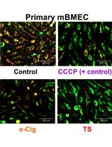 Analysis of the Mitochondrial Membrane Potential Using the Cationic JC-1 Dye as a Sensitive Fluorescent Probe