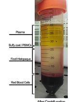 Assessment of Humoral Alloimmunity in Mixed Lymphocyte Reaction