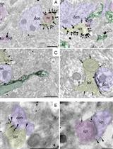 High-resolution Immunoelectron Microscopy Techniques for Revealing Distinct Subcellular Type 1 Cannabinoid Receptor Domains in Brain