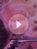 一种离体研究昼夜节律的小鼠触须毛囊培养方法