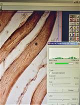 Immunohistochemical Staining of TLR4 in Human Skeletal Muscle Samples