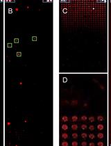 In situ, Cell-free Protein Expression on Microarrays and Their Use for the Detection of Immune Responses