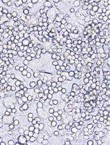 Induced Germinal Center B Cell Culture System