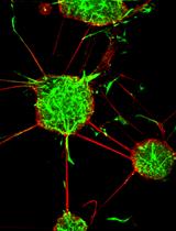 Isolation of Neural Stem Cells from the Embryonic Mouse Hippocampus for in vitro Growth or Engraftment into a Host Tissue