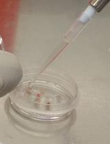 Isolation of Multipotent Mesenchymal Stem Cells from Human Extraocular Muscle Tissue