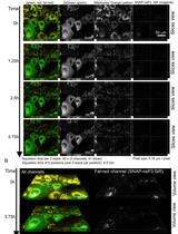 On-demand Labeling of SNAP-tagged Viral Protein for Pulse-Chase Imaging, Quench-Pulse-Chase Imaging, and Nanoscopy-based Inspection of Cell Lysates