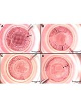 A New Efficient Method for Measuring Oxygen Consumption Rate  Directly ex vivo in Human Epidermal Biopsies