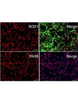 人诱导多能干细胞 (iPSCs) 分化为前脑神经祖细胞和成熟神经元的有效模型