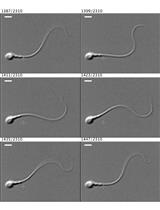 Single-cell Motility Analysis of Tethered Human Spermatozoa