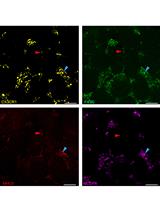 Characterization of Mouse Adult Testicular Macrophage Populations by Immunofluorescence Imaging and Flow Cytometry