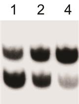 Quantification of Queuosine Modification Levels in tRNA from  Human Cells Using APB Gel and Northern Blot