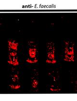 Biofilm Assays on Fibrinogen-coated Silicone Catheters and 96-well Polystyrene Plates