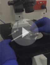 Straight Channel Microfluidic Chips for the Study of Platelet Adhesion under Flow