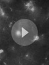 Time-lapse Whole-field Fluorescence Imaging of Microglia Processes Motility in Acute Mouse Hippocampal Slices and Analysis