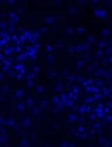 Immunofluorescence Staining of WT-1/Podocalyxin on Mouse Kidney Sections