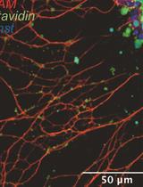 Preparation and Manipulation of Olfactory Epithelium Explant Cultures for Measurement of the Mechanical Tension of Individual Axons Using the Biomembrane Force Probe