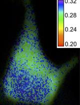 Triple Fluorescence Anisotropy Reporter Imaging in Living Cells