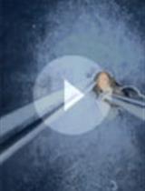 Hypochlorous Acid Staining with R19-S in the <em>Drosophila</em> Intestine upon Ingestion of Opportunistic Bacteria